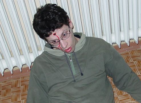 Pripínačka v čele? Nepríjemné...